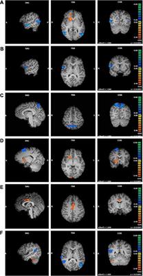 Trait Mindfulness and Functional Connectivity in Cognitive and Attentional Resting State Networks